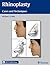 Rhinoplasty: Cases and Techniques
