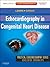 Echocardiography in Congeni...