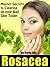 Rosacea "Master Secrets to Clearing up your Bad Skin Today!"