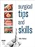 Surgical Tips and Skills