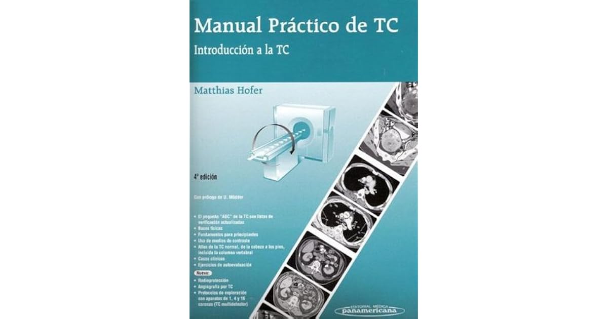 Manual Practico de Tc Introduccion a la Tc 4b: Edicion by Matthias Hofer