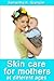 Skin care for mothers at di...