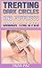 Treating dark circles and puffiness under the eyes (Natural Treatments Book 3)