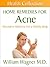 Home Remedies for Acne: Alternative Medicine for a Healthy Body (Health Collection)