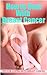How to Deal With Breast Cancer