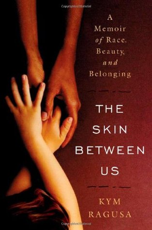 The Skin Between Us: A Memoir of Race, Beauty, and Belonging (Hardcover)