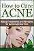 How to Cure Acne: Natural Treatments and Remedies for Achieving Clear Skin (Acne Cure, Acne Diet, Acne Scar, Acne Care, Acne Free)