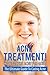 Acne Treatment- How To Cure Acne Forever ! (acne remedies,acne treatment, acne scar,acne no more, acne care, acne diet,)