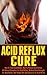 Acid Reflux Cure: How to Treat Acid Reflux, How to Prevent Acid Reflux, All Natural Remedies for Acid Reflux, Medical Breakthroughs for Acid Reflux, and Proper Diet and Exercise for Acid Reflux