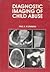 Diagnostic Imaging of Child Abuse