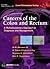 Cancers of the Colon and Rectum by Charles R. Thomas Jr.