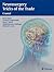 Neurosurgery Tricks of the ...