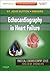 Echocardiography in Heart Failure- E-BOOK by Martin G. St. John Sutton