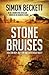 Stone Bruises
