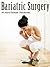 Bariatric Surgery (Around The World One Of The Most Important Medical Procedures Used To Treat Obesity Is Bariatric Surgery-Read This Book Book 1)