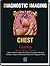 Diagnostic Imaging: Chest
