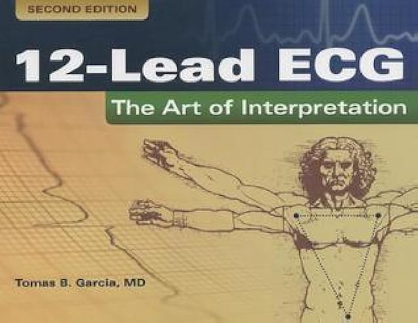 12-Lead ECG: The Art of Interpretation: The Art of Interpretation (Garcia, Introduction to 12-Lead ECG)