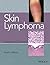 Skin Lymphoma: The Illustrated Guide
