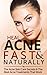 Heal Acne Fast & Naturally: Acne Skin Care Secrets & The Best Acne Treatments That Work: (Dietary Cure for Acne, Acne Vulgaris, Acne Prevention, Natural Skincare, Acne Skincare)