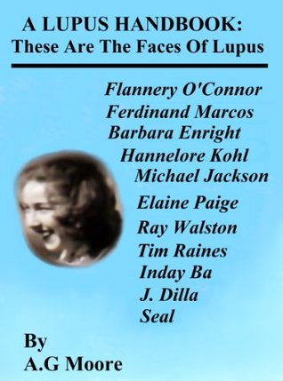A Lupus Handbook: These Are the Faces of Lupus (Kindle Edition)