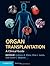 Organ Transplantation by Andrew A. Klein