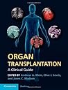 Organ Transplantation: A Clinical Guide