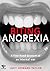 Biting Anorexia