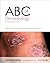 ABC of Dermatology (ABC Series)