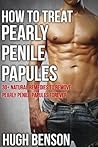 How to Treat Pearly Penile Papules - 30+ Natural Remedies to Remove Pearly Penile Papules Forever