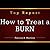 How to Treat a Burn: Burn Treatment Report. Learn How to Treat Burns the Right Way