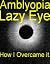 Amblyopia (Amplyopia Lazy E...
