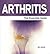 Arthritis: The Essential Guide (Need2Know Books Book 104)