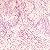 Genes and Disease - Ear, No...