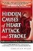 Hidden Causes of Heart Atta...