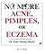 No More Acne, Pimples or Eczema: How to cure your skin or your money back