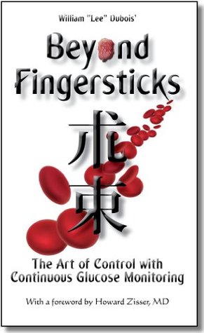 Beyond Fingersticks: The art of control with continuous glucose monitoring