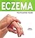 Eczema: The Essential Guide
