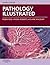 Pathology Illustrated E-Book