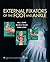 External Fixators of the Foot and Ankle by Paul  Cooper