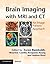 Brain Imaging with MRI and CT by Zoran Rumboldt