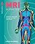 MRI in Practice by Catherine Westbrook