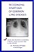 Recognizing Symptoms of Common Lung Diseases by Nicholas DiFilippo