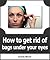 How to Get Rid Of Bags Under Eyes