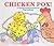Chicken Pox! : A Touch-And-Feel Pull-Tab Book
