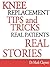 Knee Replacement Tips and Tricks by Mark Clayson