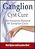 Ganglion Cyst Cure: Complete guide to ganglion cyst causes, types, symptoms, treatment and prevention.