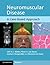 Neuromuscular Disease: A Case-Based Approach