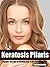 Keratosis Pilaris "Master Secrets to Getting Rid of KP Bumps Today!"