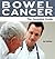 Bowel Cancer: The Essential Guide (Need2Know Books Book 107)