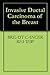 Invasive Ductal Carcinoma of the Breast